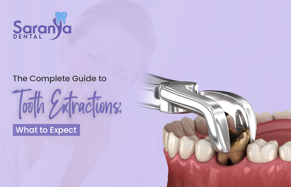 This comprehensive guide will provide you with everything you need to know about tooth extractions.