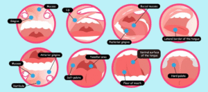 Oral Cancer Screening in the Dental Chair