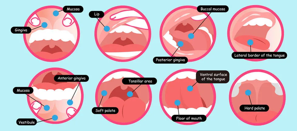 Oral Cancer Screening in the Dental Chair
